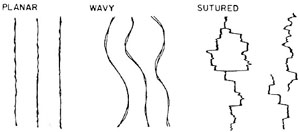 Geometry of pressure solution seams, sutured and non-sutured. Non-sutured may be planar, wavy, and anastamosing. From Engelder and Marshak (1985).