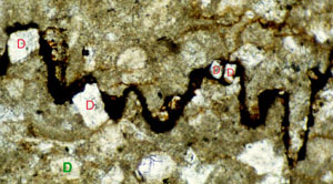 Photomicrograph of a pressure solution seam. Black material is the residue. White minerals in picture are dolomite; they are labeled in red D in the styolite and one labeled in green D in the surrounding rock. Note that dolomites have been accumulated in the residue and they are commonly located at the tip of the stylolite column because of its low pressure solubility. Photo taken in plane-polarized light. Sample from Devonian carbonates, Alpena, Michigan. From web site of L. Bruce Railsback, http://www.gly.uga.edu/railsback.